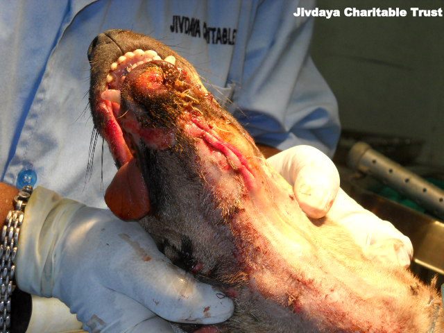 The jaw Fixed completely by the doctors